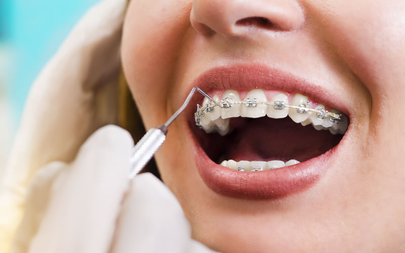 Ortodoncia y Ortopedia Dentofacial