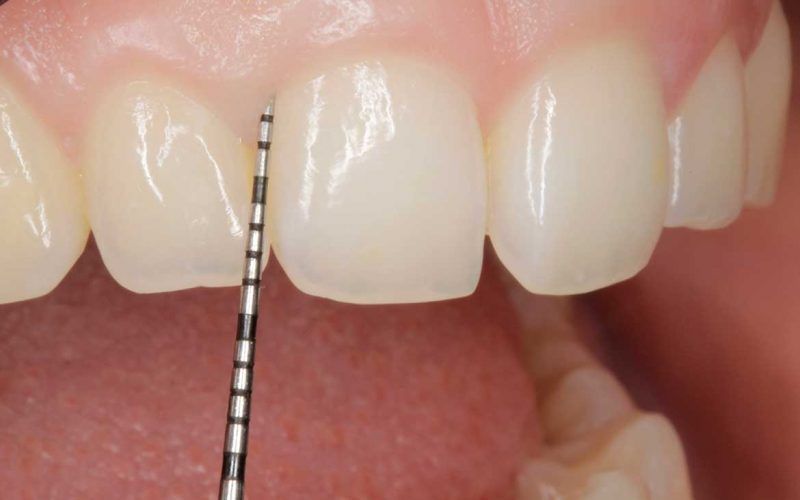 Periodoncia UniCIEO