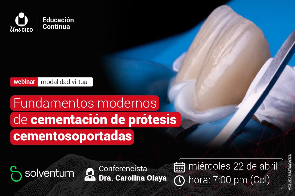 WEBINAR: Fundamentos modernos de cementación de prótesis cementosoportadas