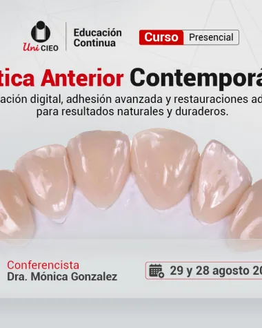 Estética Anterior Contemporánea: Planeación digital, adhesión avanzada y restauraciones aditivas para resultados naturales y duraderos