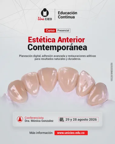 Estética Anterior Contemporánea: Planeación digital, adhesión avanzada y restauraciones aditivas para resultados naturales y duraderos