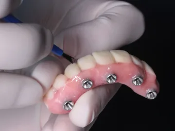 Implantología Oral y Reconstructiva