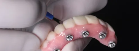 Implantología Oral y Reconstructiva