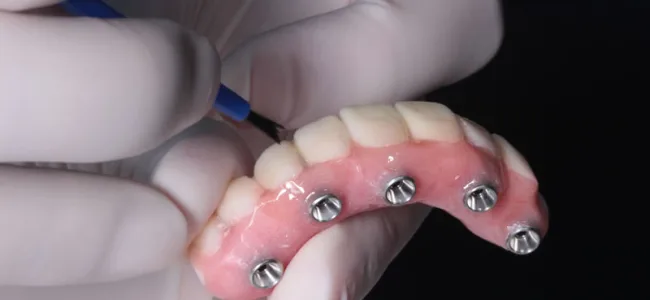 Implantología Oral y Reconstructiva UniCIEO