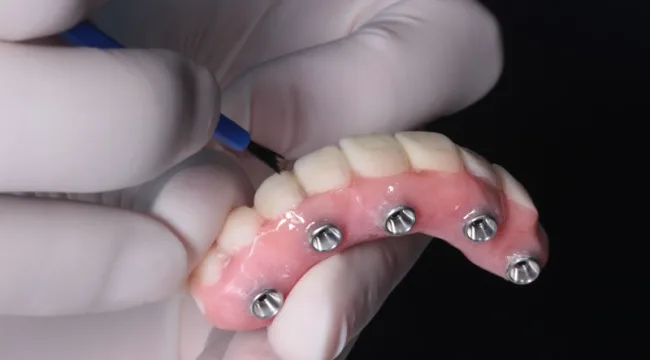UniCIEO Implantología Oral y Reconstructiva