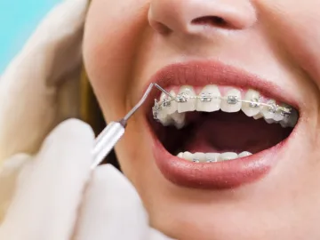 Ortodoncia y Ortopedia Dentofacial
