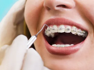 Ortodoncia y Ortopedia Dentofacial