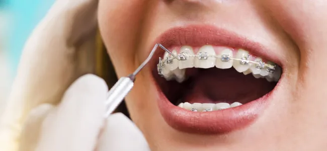 Ortodoncia y Ortopedia Dentofacial UniCIEO
