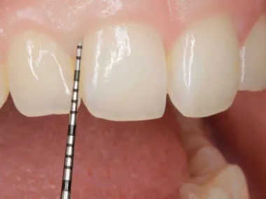 Periodoncia