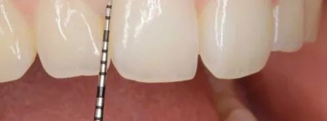 Periodoncia