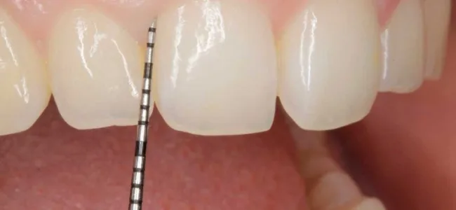 Periodoncia UniCIEO