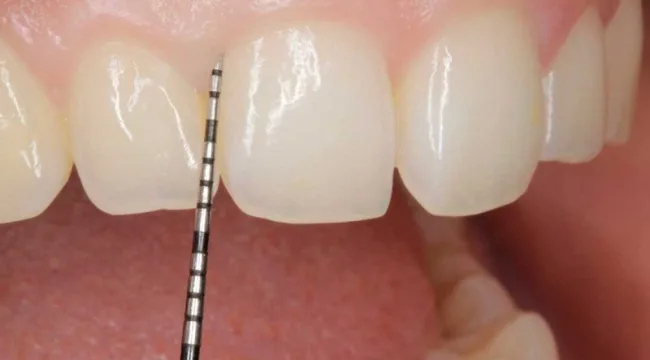 UniCIEO Periodoncia