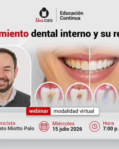 WEBINAR: Aclaramiento dental interno y su realidad