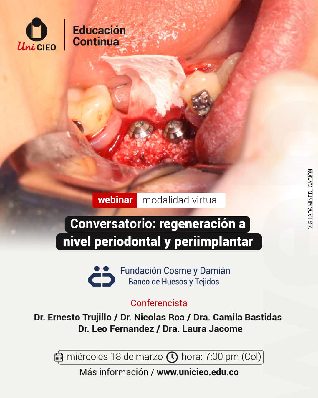 Regeneración a nivel periodontal y periimplantar