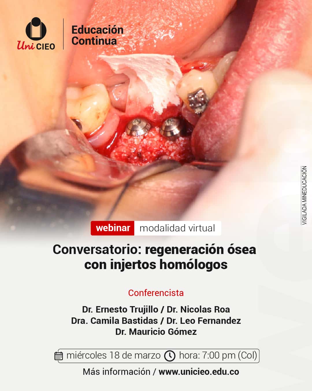 Regeneración ósea con injertos homólogos