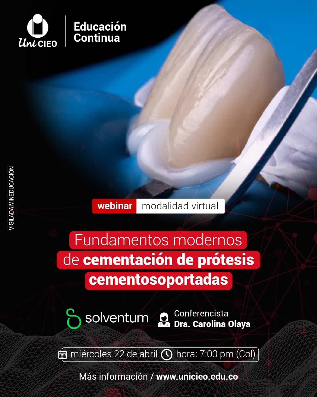 Fundamentos modernos de cementación de prótesis cementosoportadas