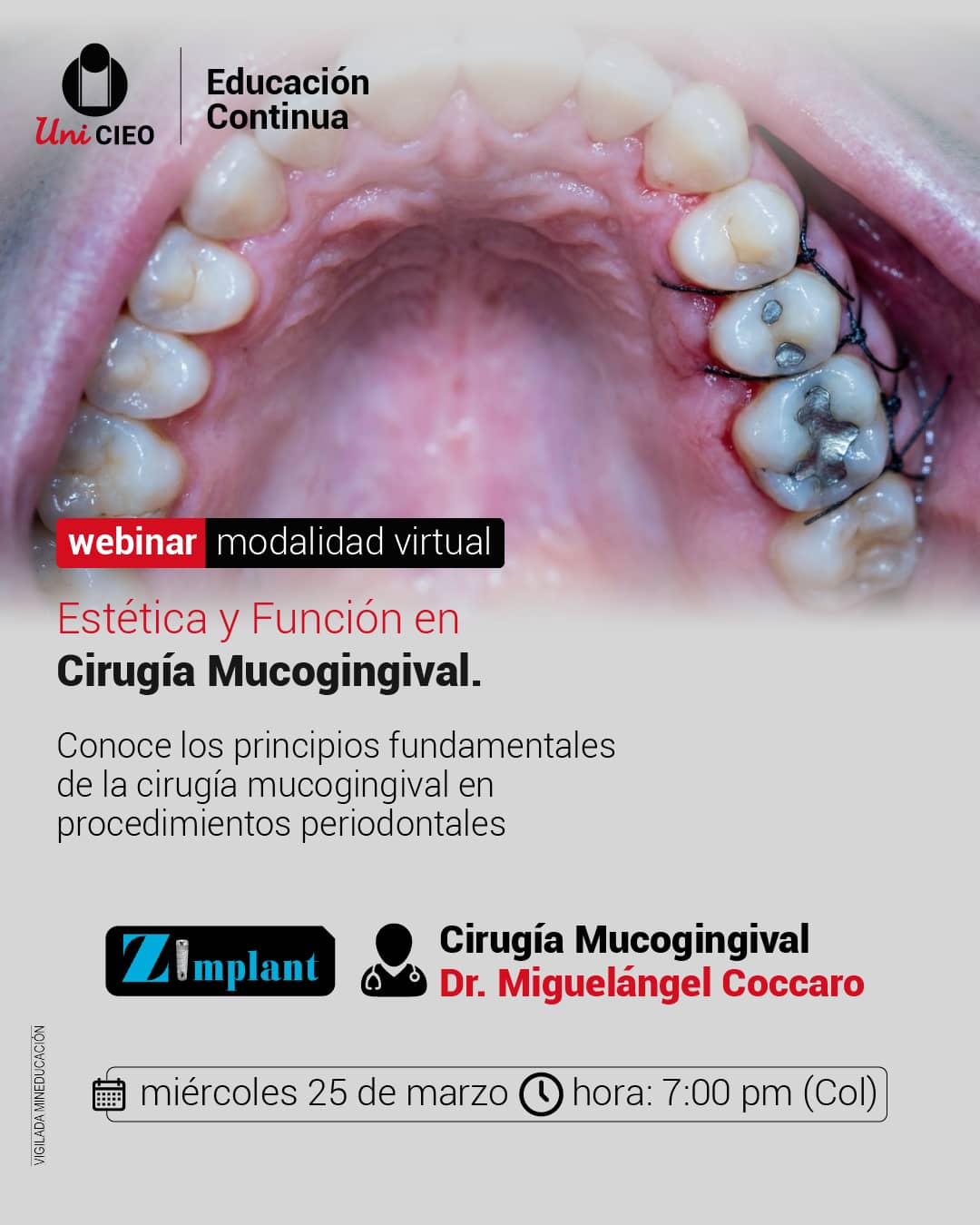 Estética y Función en Cirugía Mucogingival
