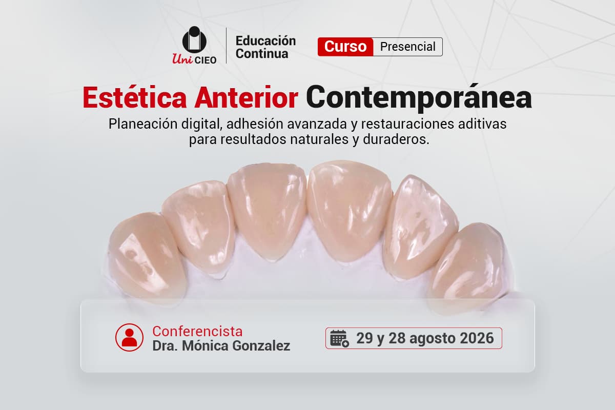 carillas esteticas