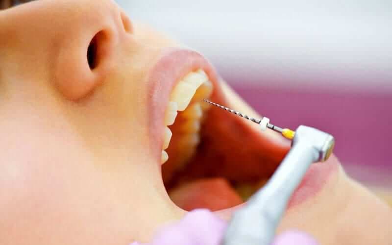 Endodoncia