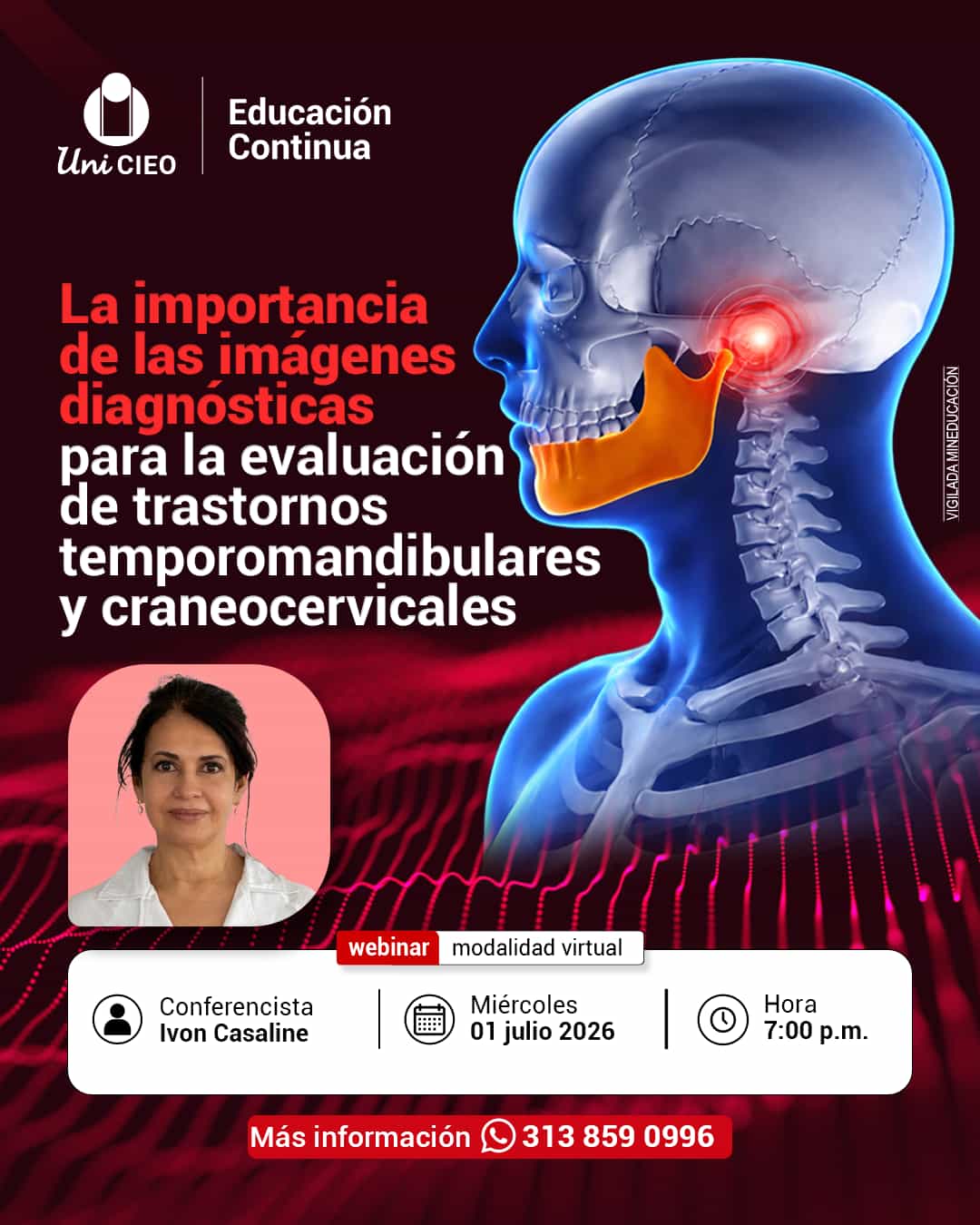 Post 2 — UNICIEO